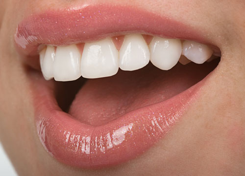 How to Improve the Appearance of your Teeth