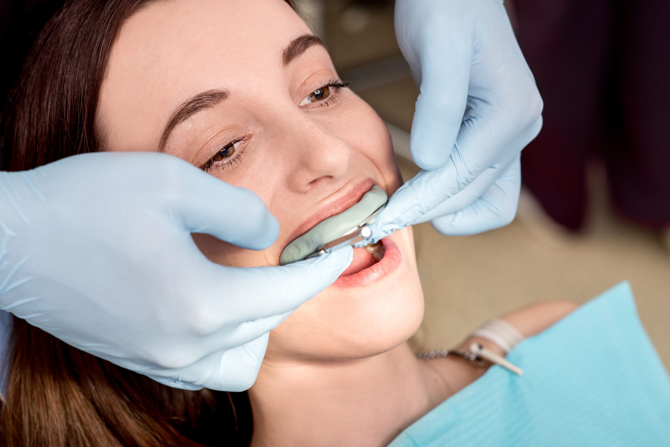 Teeth Grinding – Causes and Prevention
