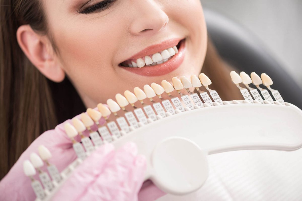 Fluorosis Stains – Will Dental Veneers or Teeth Whitening Help?