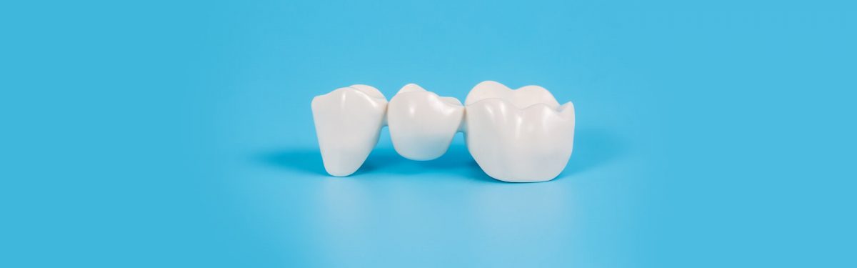Uses of Dental Crowns in Dentistry 