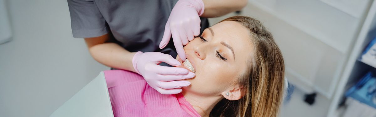 What Should You Expect During a Teeth Whitening Appointment?
