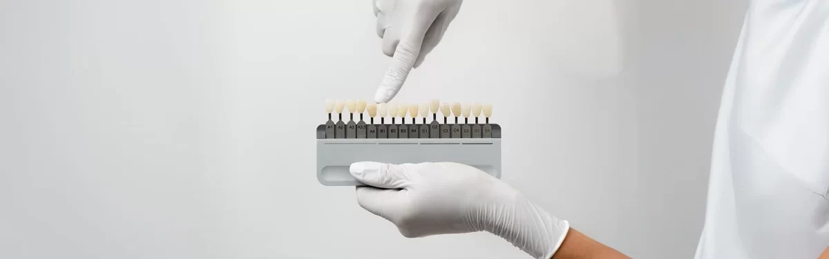 Veneers for Gapped Teeth: How to Close Tooth Gaps for Good