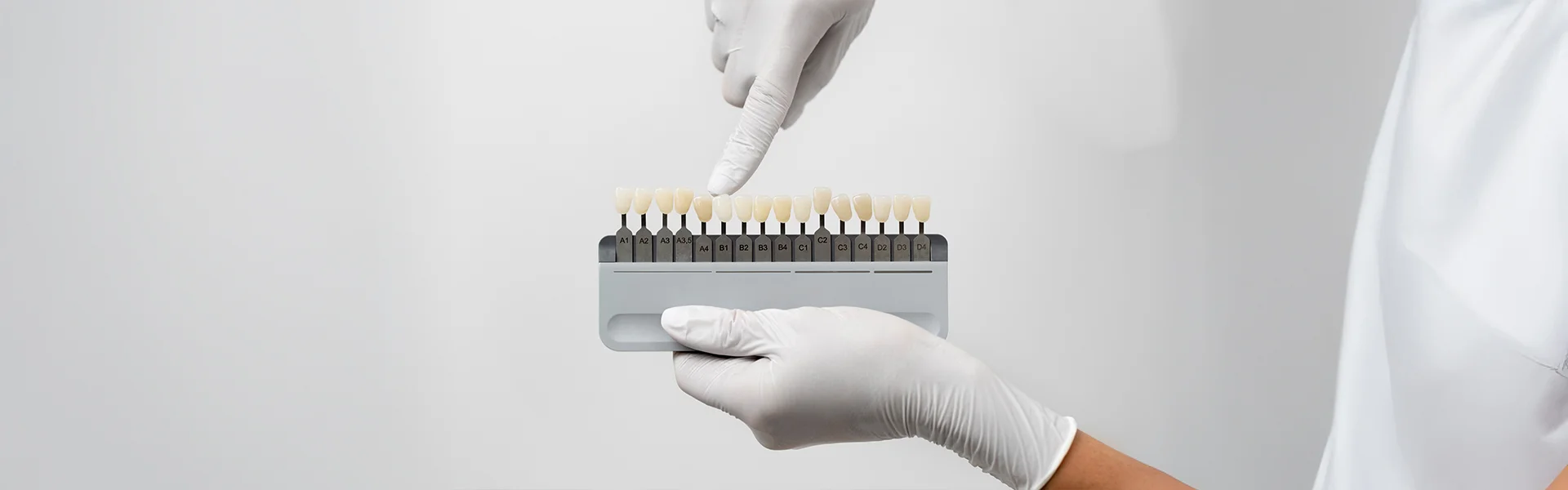 Veneers for Gapped Teeth: How to Close Tooth Gaps for Good